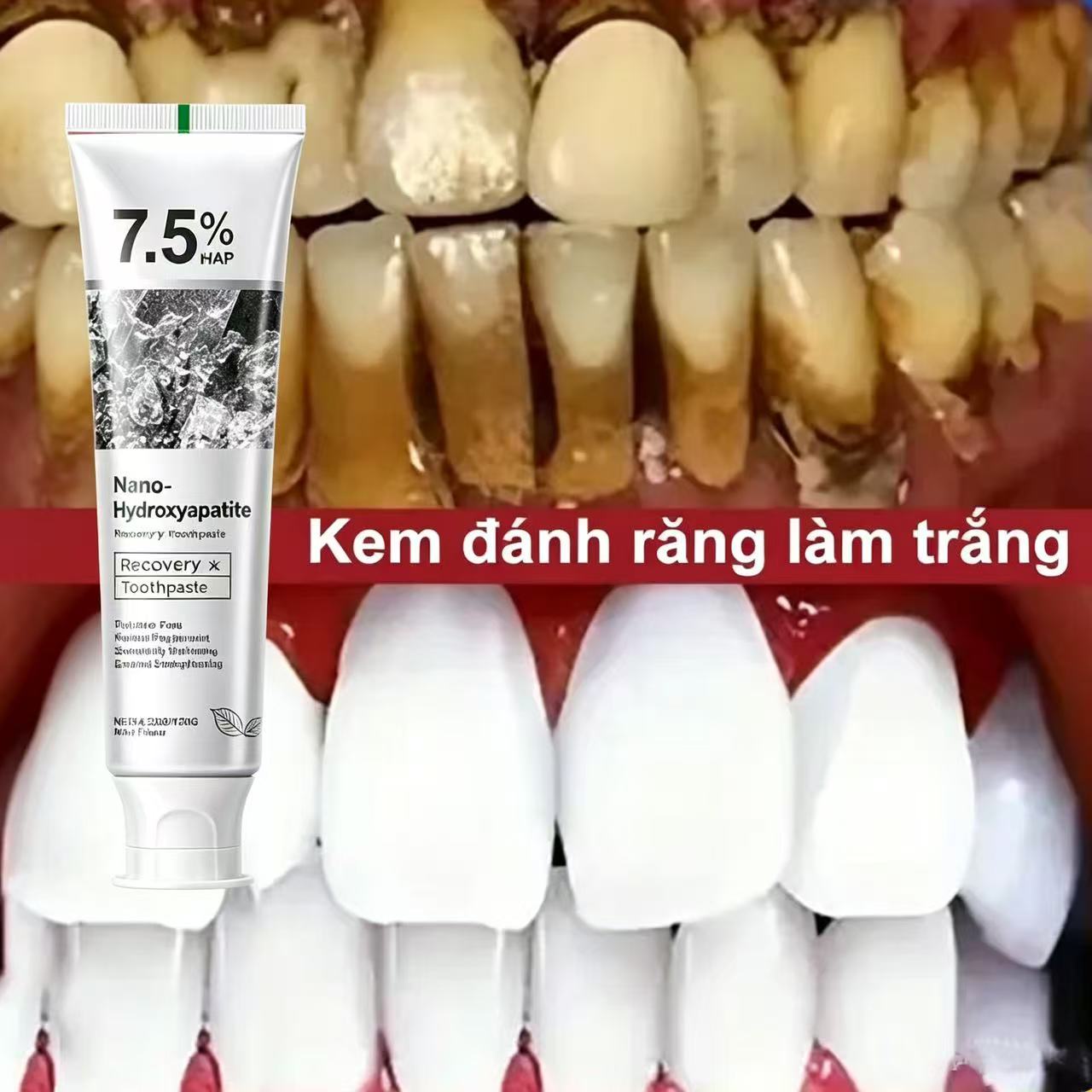 Teeth Whitening Best - 7,5% Hydroksyapatytowa Probiotyczna Pasta do Zębów