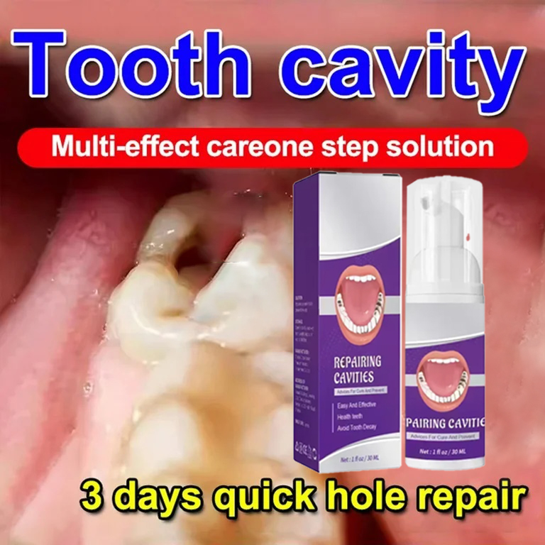 Teeth Whitening Best - Pasta do czyszczenia zębów usuwa przebarwienia,