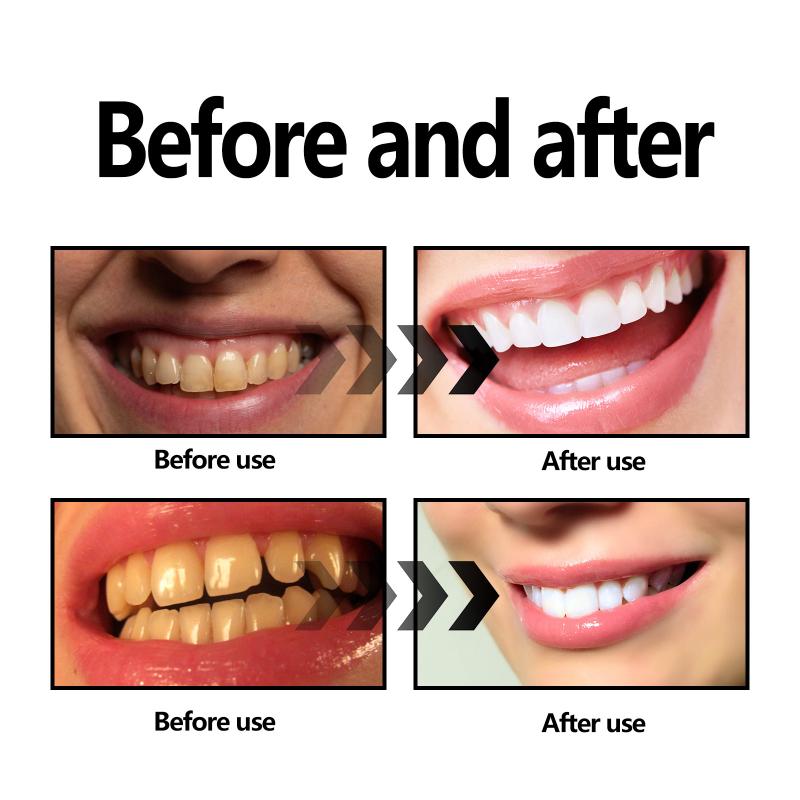 Proszek do wybielania zębów z  – Teeth Whitening Baking Soda recenzja i cena