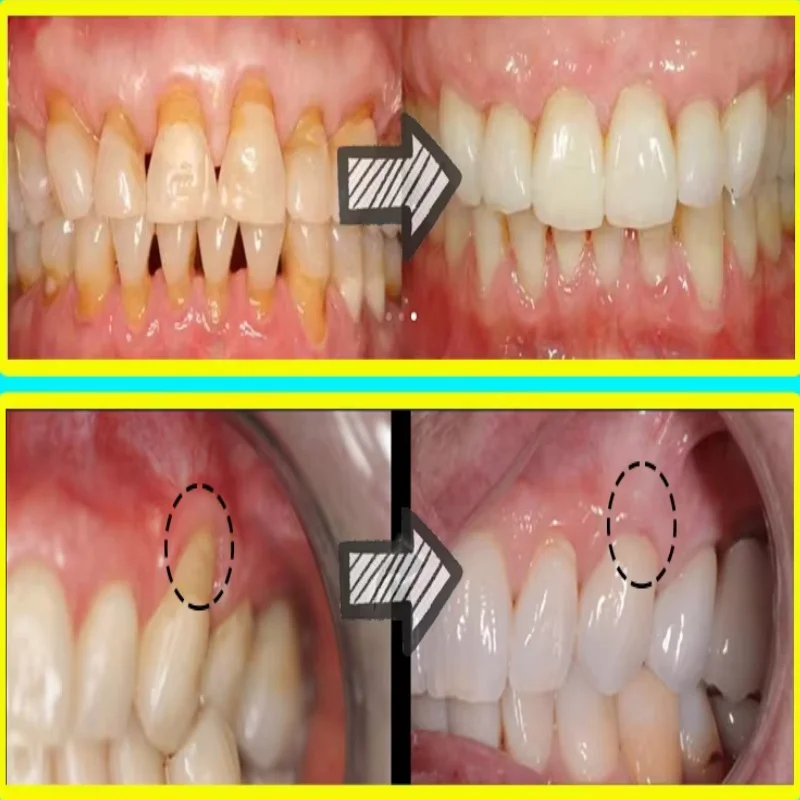 Szybkie Serum do Łagodzenia Za – Teeth Whitening Baking Soda recenzja i cena