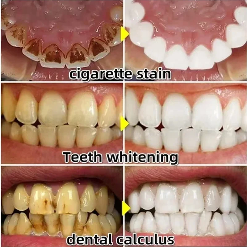 Szybkie Serum do Łagodzenia Za – Teeth Whitening Baking Soda recenzja i cena