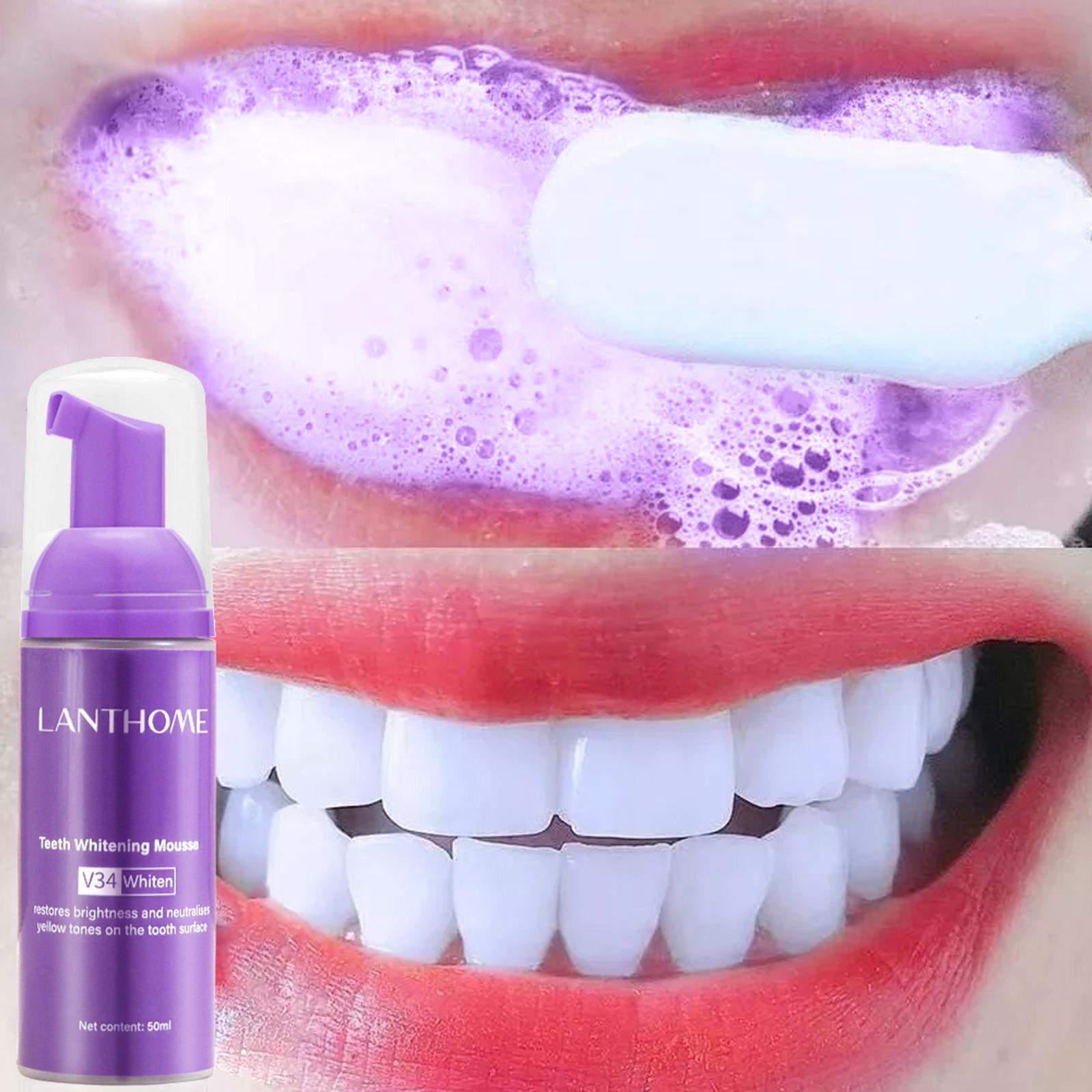V34 Mus do czyszczenia zębów P – Teeth Whitening Best recenzja i cena