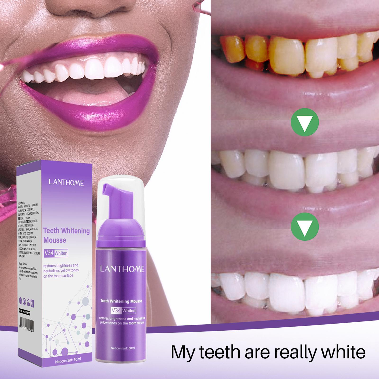 V34 Mus do czyszczenia zębów P – Teeth Whitening Best recenzja i cena