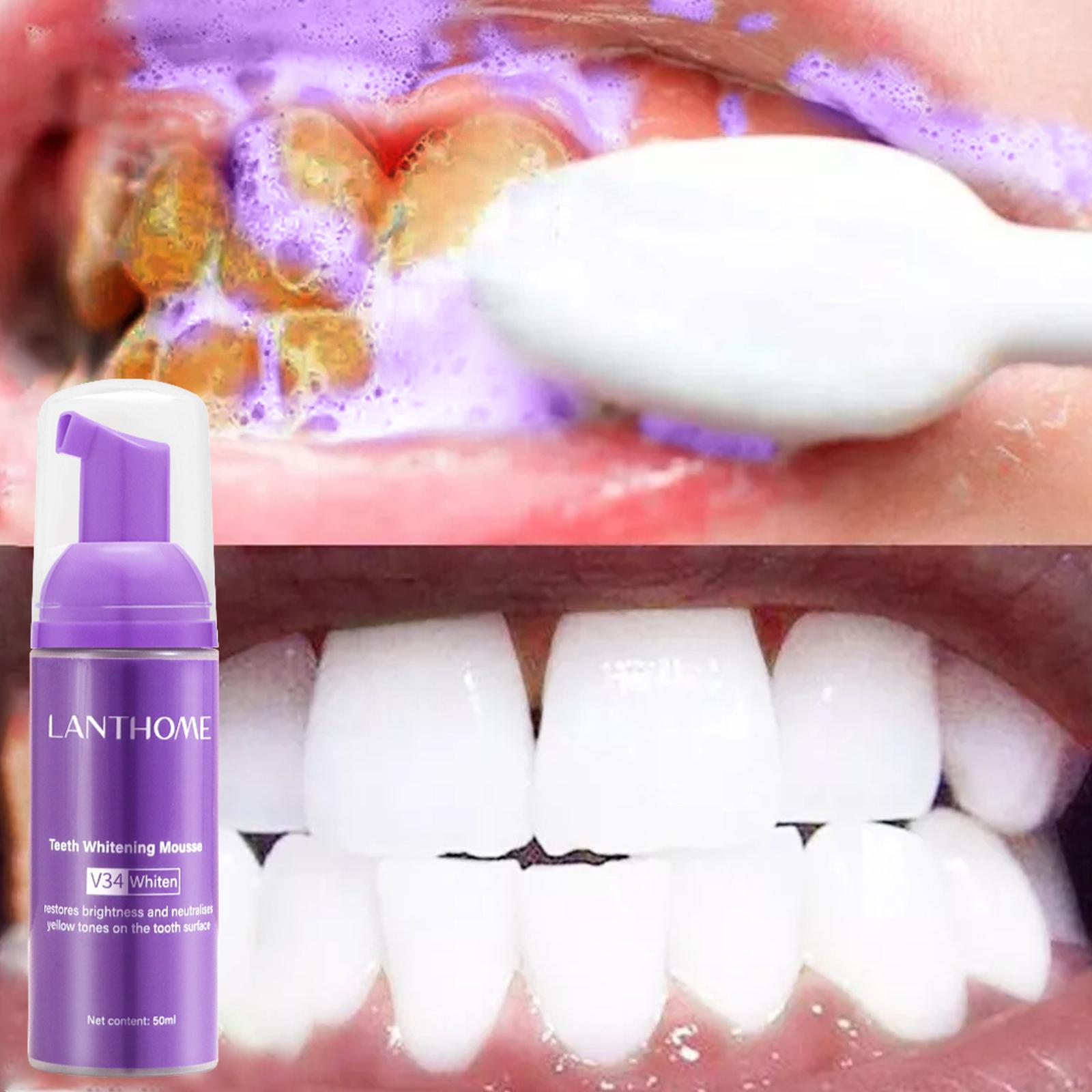 V34 Mus do czyszczenia zębów P – Teeth Whitening Best recenzja i cena