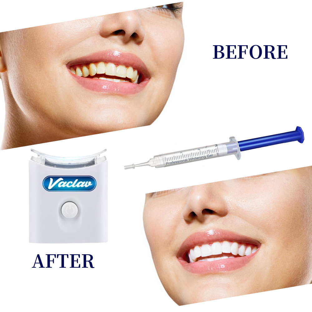 Żel do wybielania zębów w strz – Teeth Whitening Baking Soda recenzja i cena