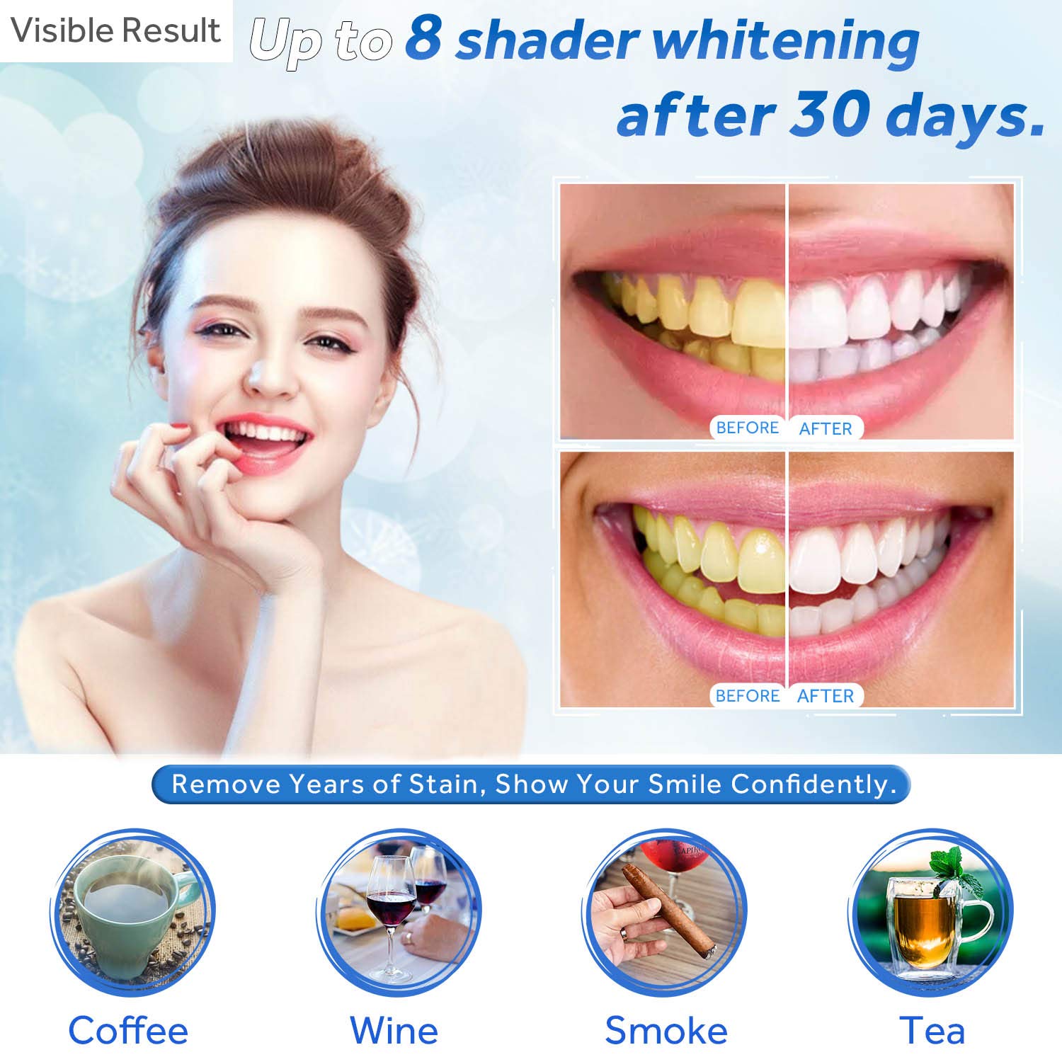 Żel do wybielania zębów w strz – Teeth Whitening Gel Refills recenzja i cena
