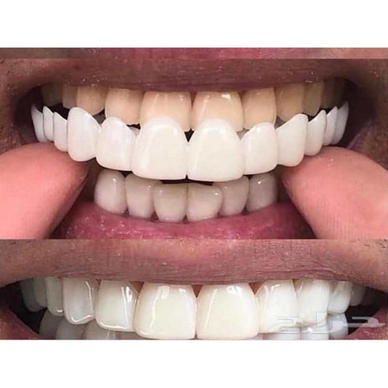 Miękki żel silikonowy Dental O – Teeth Whitening Moulds recenzja i cena
