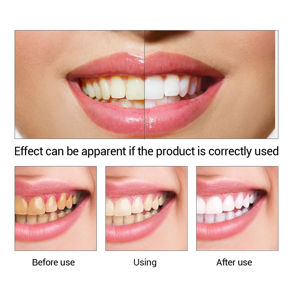 FTEENPLY esencja do wybielania – Teeth Whitening Essence recenzja i cena