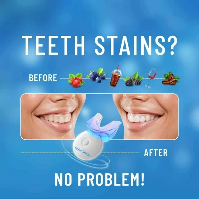 Wysokiej jakości zestaw do czy – Teeth Whitening Kit At Home recenzja i cena