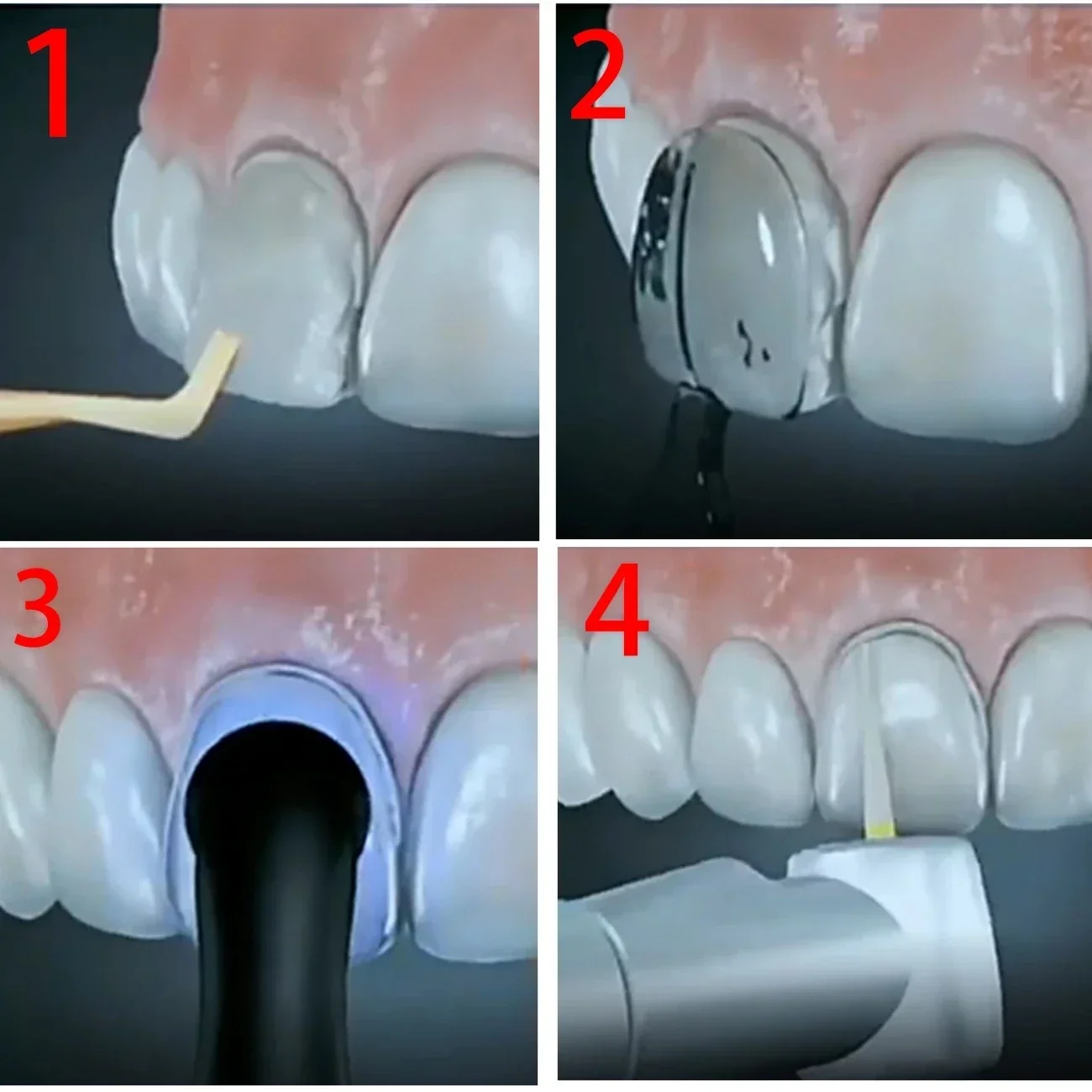2 Zestawy Form do Laboratorium – Teeth Whitening Moulds recenzja i cena