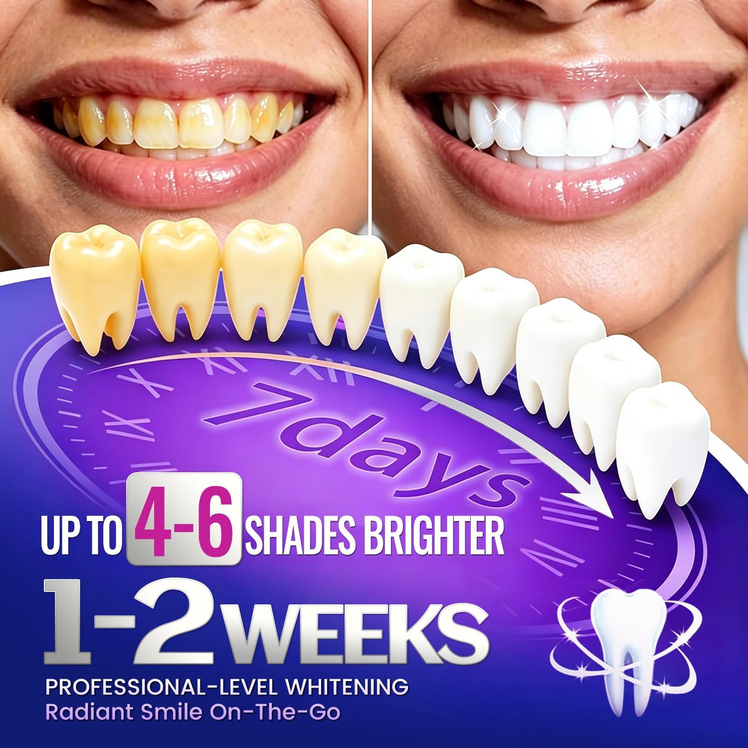 1/7 Par Pasków do Wybielania Z – Teeth Whitening Street recenzja i cena