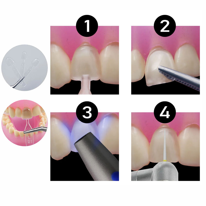 32 szt./zestaw Formy do żywicy – Teeth Whitening Moulds recenzja i cena