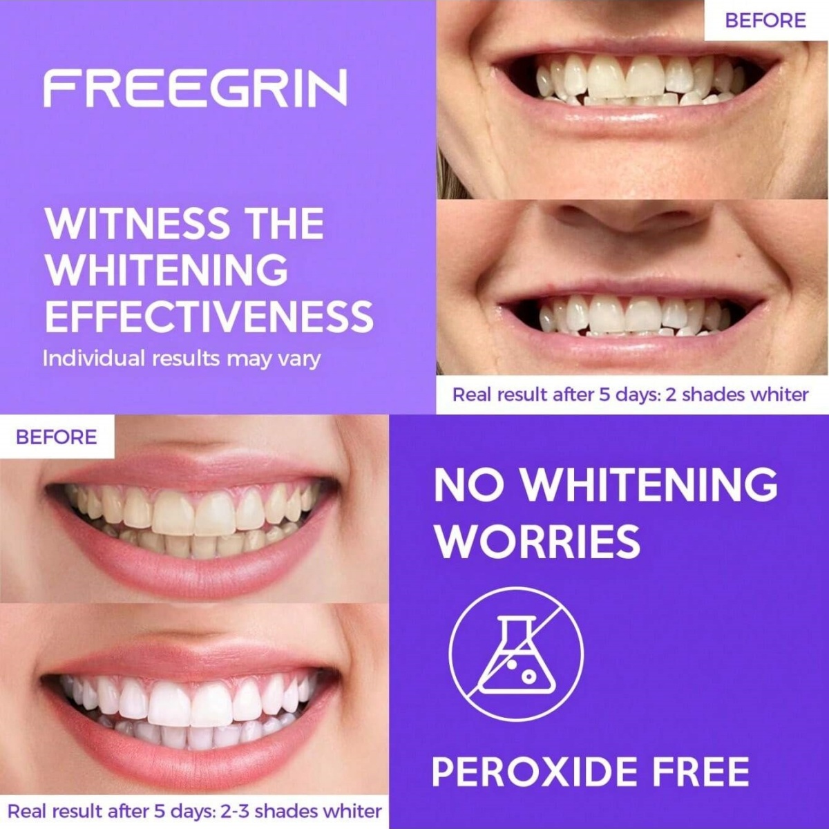 Naklejki wybielające do zębów  – Teeth Whitening Gel Refills recenzja i cena