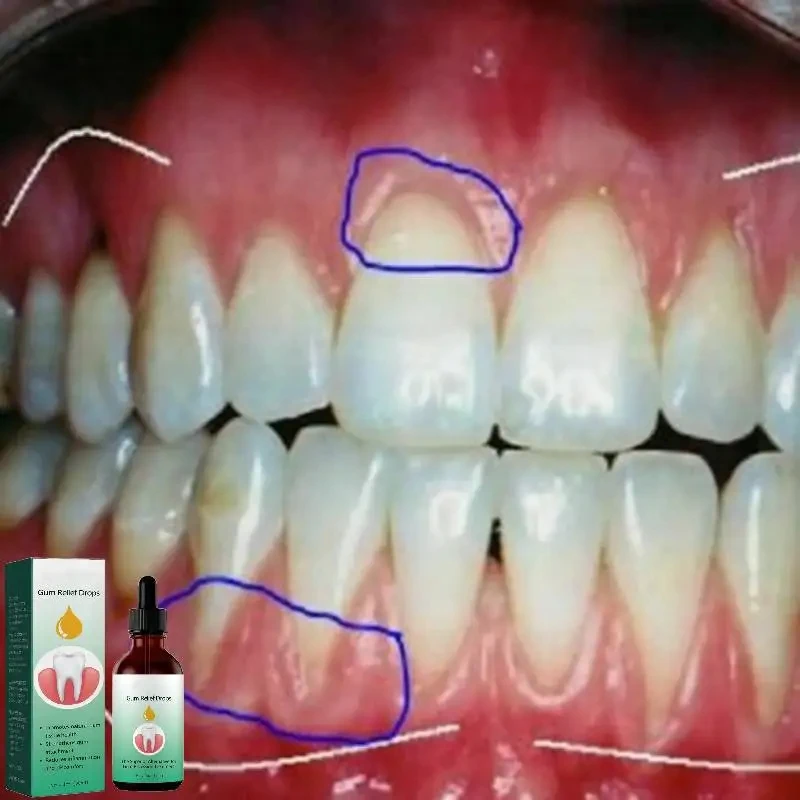 Krople do naprawy dziąseł Łago – Teeth Whitening Paste recenzja i cena