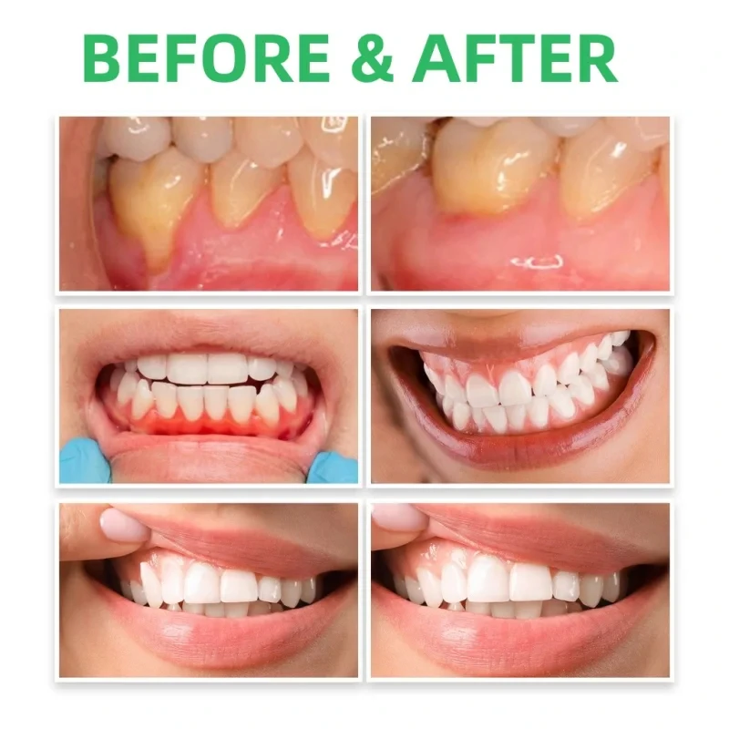 Krople do naprawy dziąseł Łago – Teeth Whitening Paste recenzja i cena