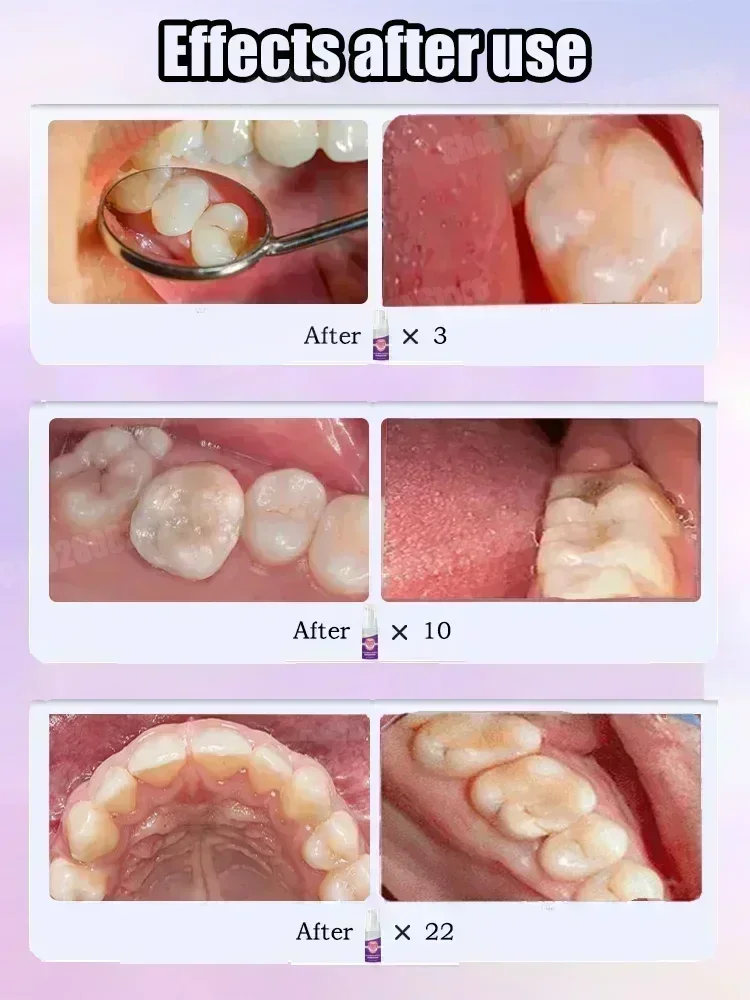 Pasta do czyszczenia zębów usu – Teeth Whitening Best recenzja i cena