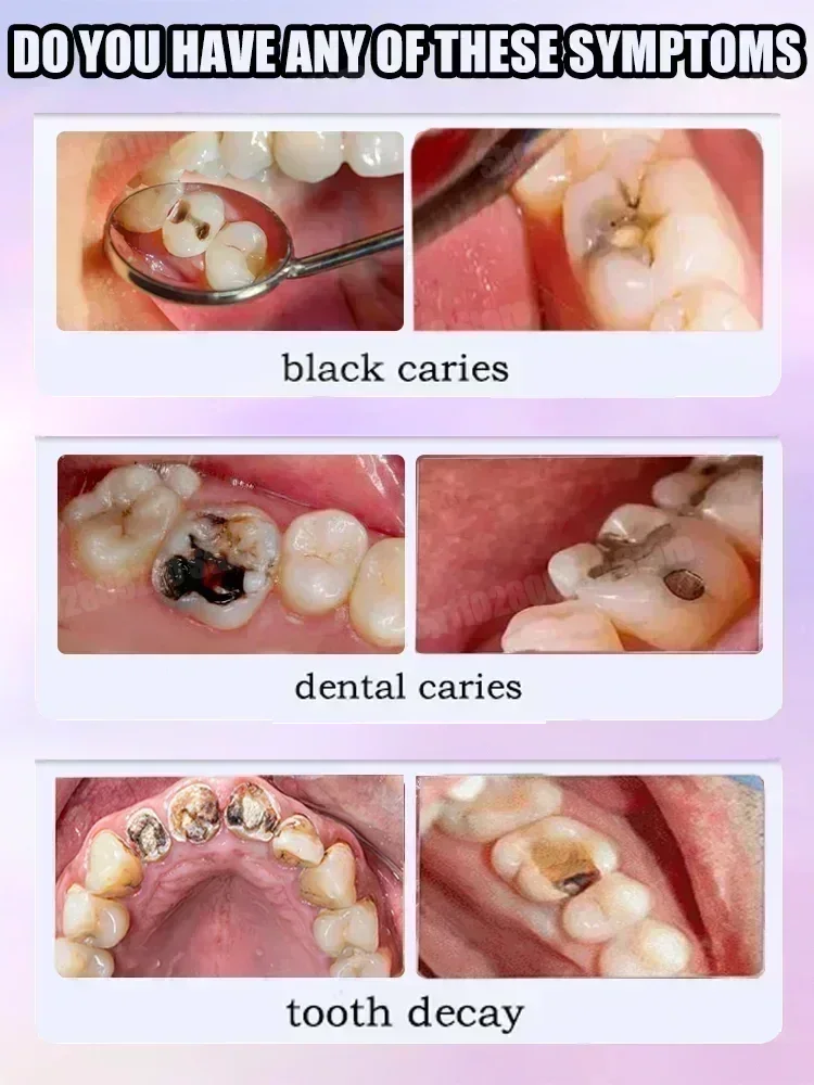Pasta do czyszczenia zębów usu – Teeth Whitening Best recenzja i cena